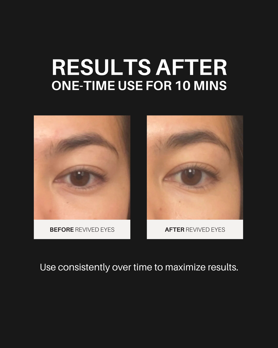 Overtime Undereye Masks